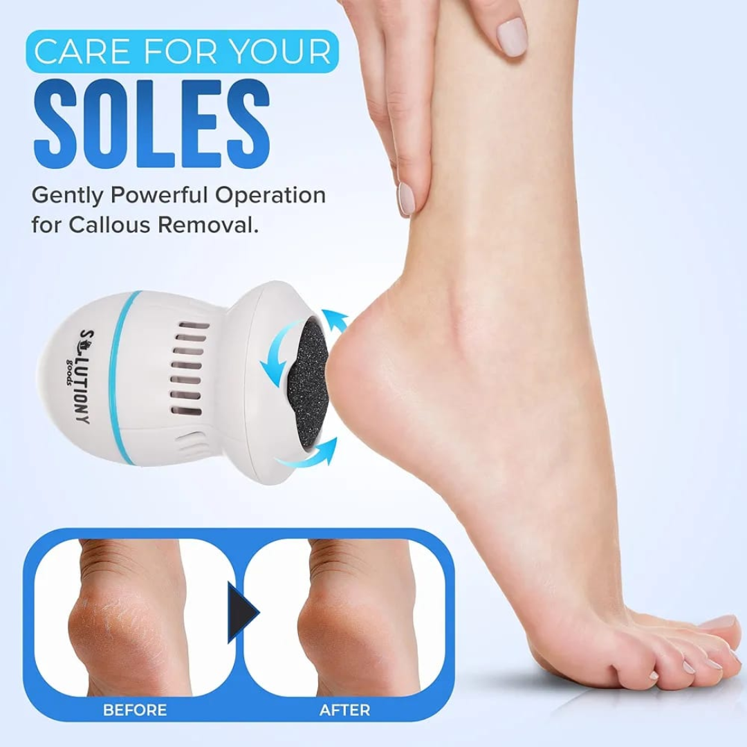 Electric Feet Callus Remover